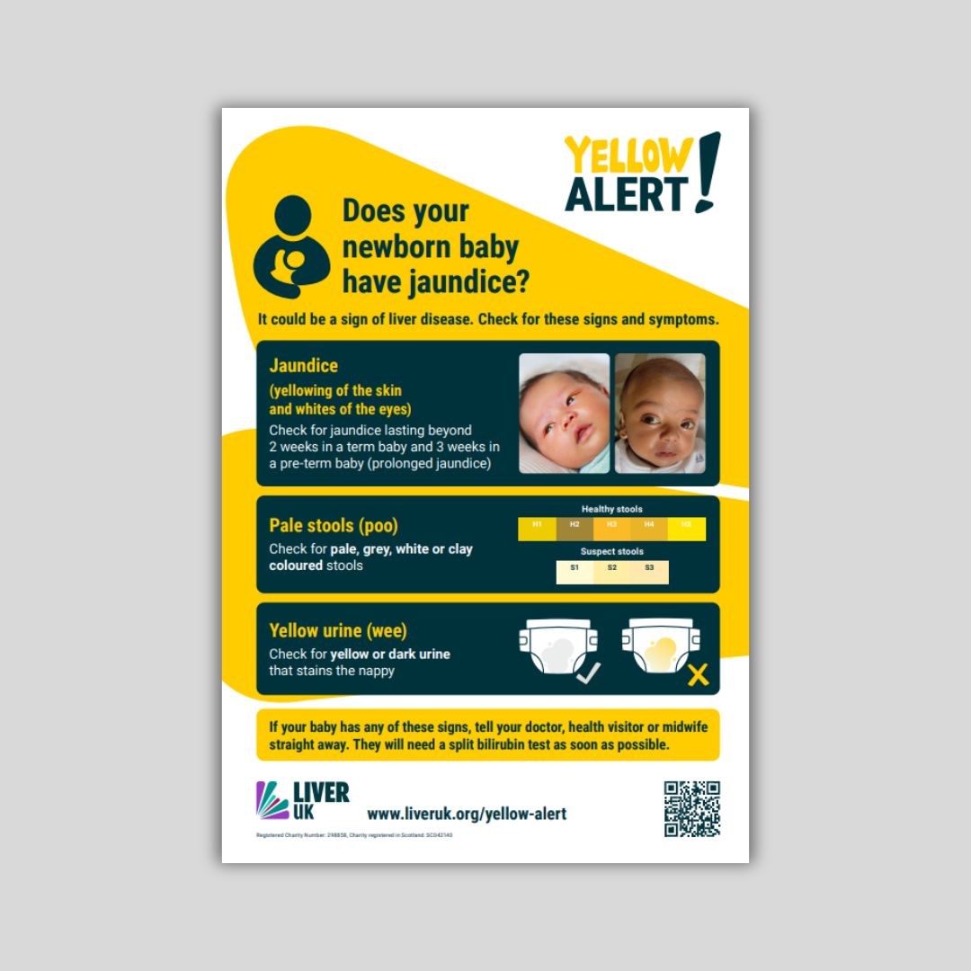 Yellow Alert Poster